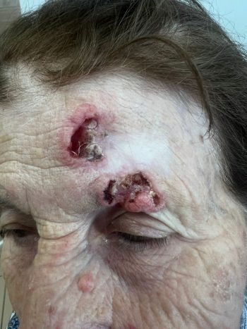 https://intramed.spb.ru/wp-content/uploads/2025/09/WhatsApp-Image-2025-08-21-at-14.48.38-350x467.jpeg